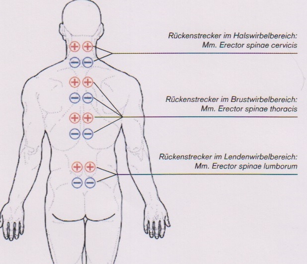 Ułożenie elektrod przykręgosłupowo