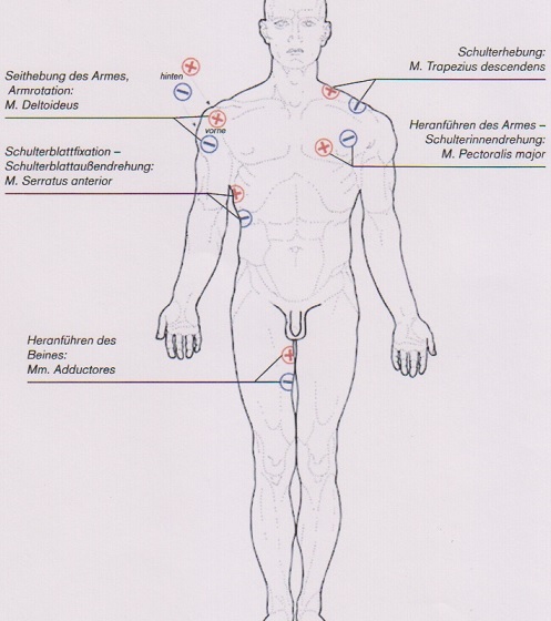 Elektrody - obręcz miedniczna