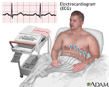 Przykładowy zapis EKG