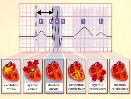 Przykładowe odcinki i odstępy na EKG