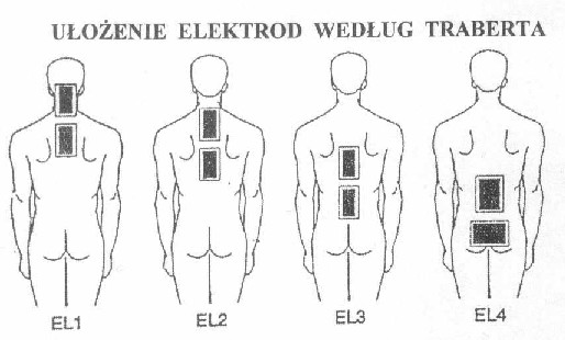 Schemat ułożenia elektrod