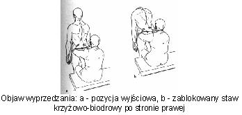 Objaw wyprzedzania — standing flexion test