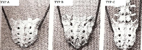 Typy kości krzyżowych