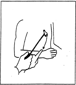 brachioradialis