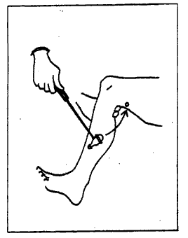 hamstring