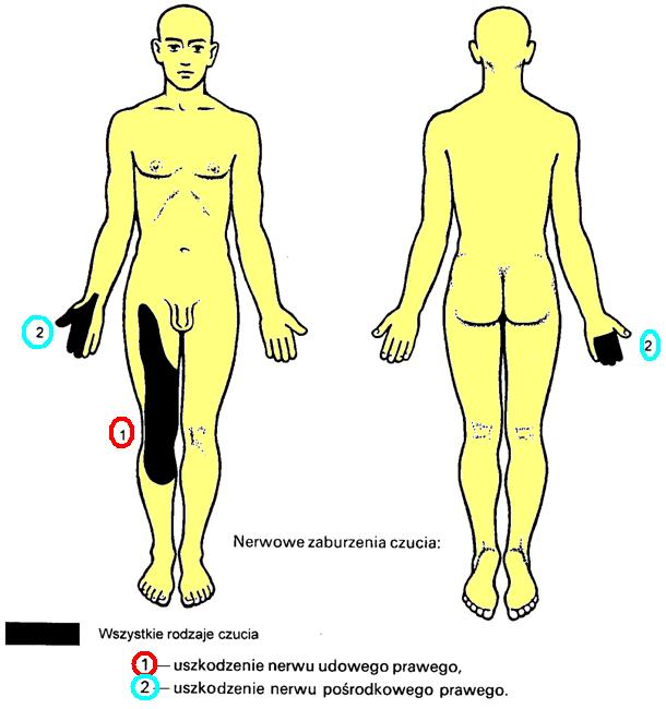 Nerwowe zaburzenia czucia