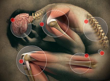 Schemat neuromatrixu bólu