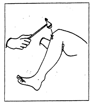 quadriceps