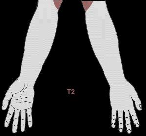 t2