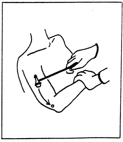 triceps